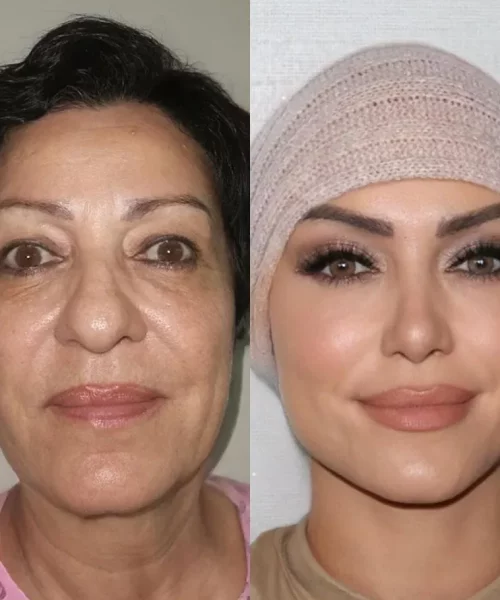 d8085844-e29d-421a-98e6-b7e14120138b